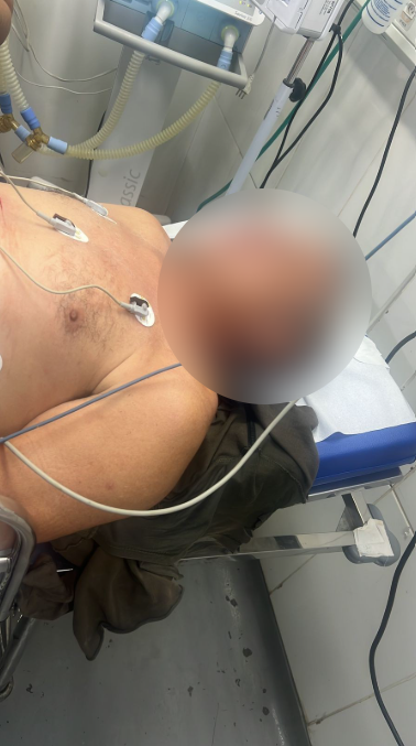 Tentativa de Homicídio é Registrada no bairro Nova Carajás, em Parauapebas